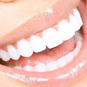 Scaling And Polishing With X-Ray At Omar Yahia Dental Surgery Clinic DENTISTRY Shop Online at Special Price from UAE Mega Deals